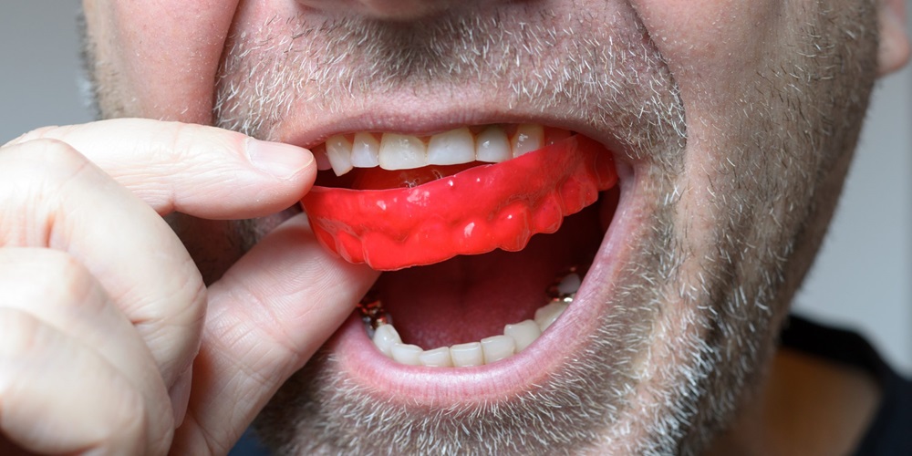 MOUTHGUARD DAY - September 2, 2024 - National Today